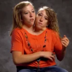Are Abby and Brittany Hensel married in 2024