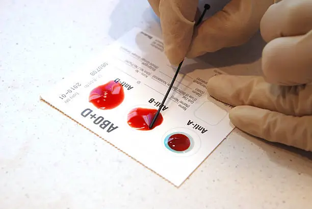What is the 3 most common blood type?