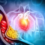 How to Reduce Cholesterol in 7 Days