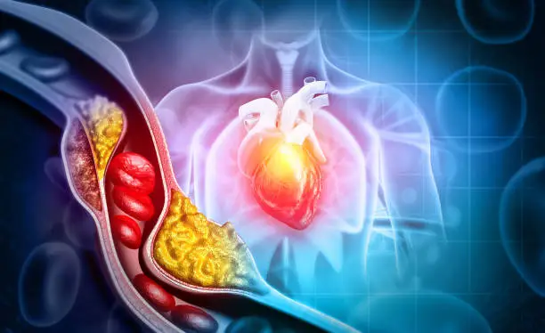 How to Reduce Cholesterol in 7 Days